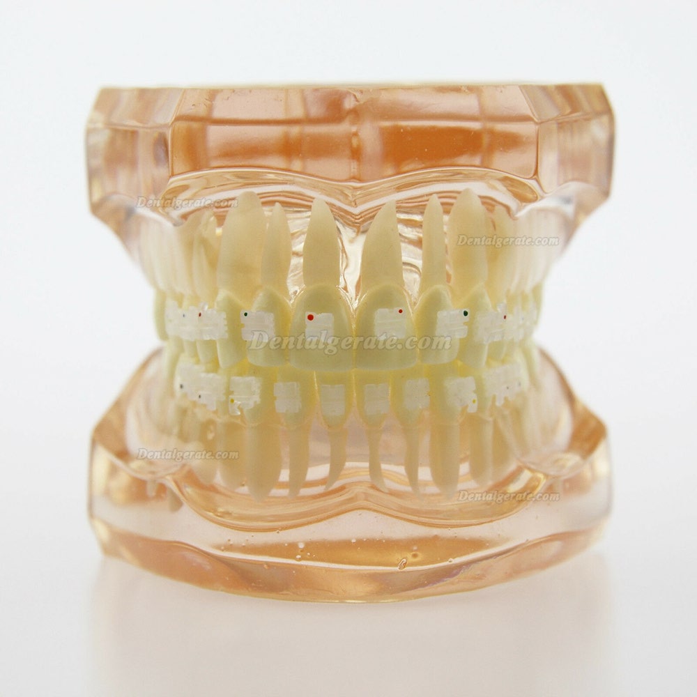 Dental Kieferorthop&auml;die Behandlung Modell Demo Z&auml;hne Keramikbrackets # 3002