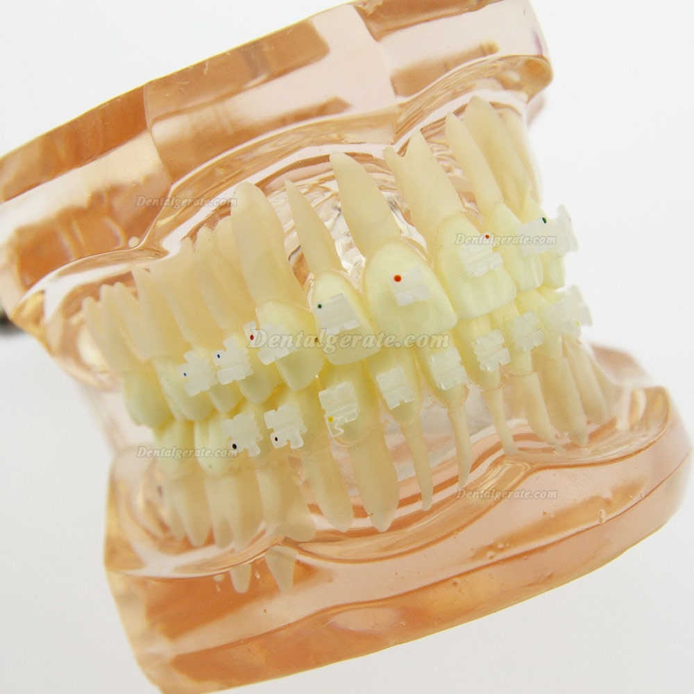 Dental Kieferorthop&auml;die Behandlung Modell Demo Z&auml;hne Keramikbrackets # 3002