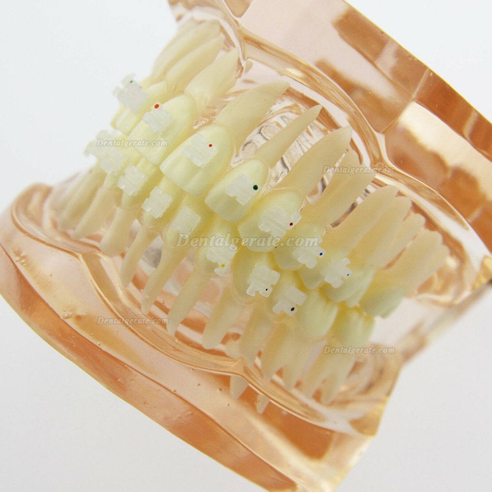 Dental Kieferorthop&auml;die Behandlung Modell Demo Z&auml;hne Keramikbrackets # 3002