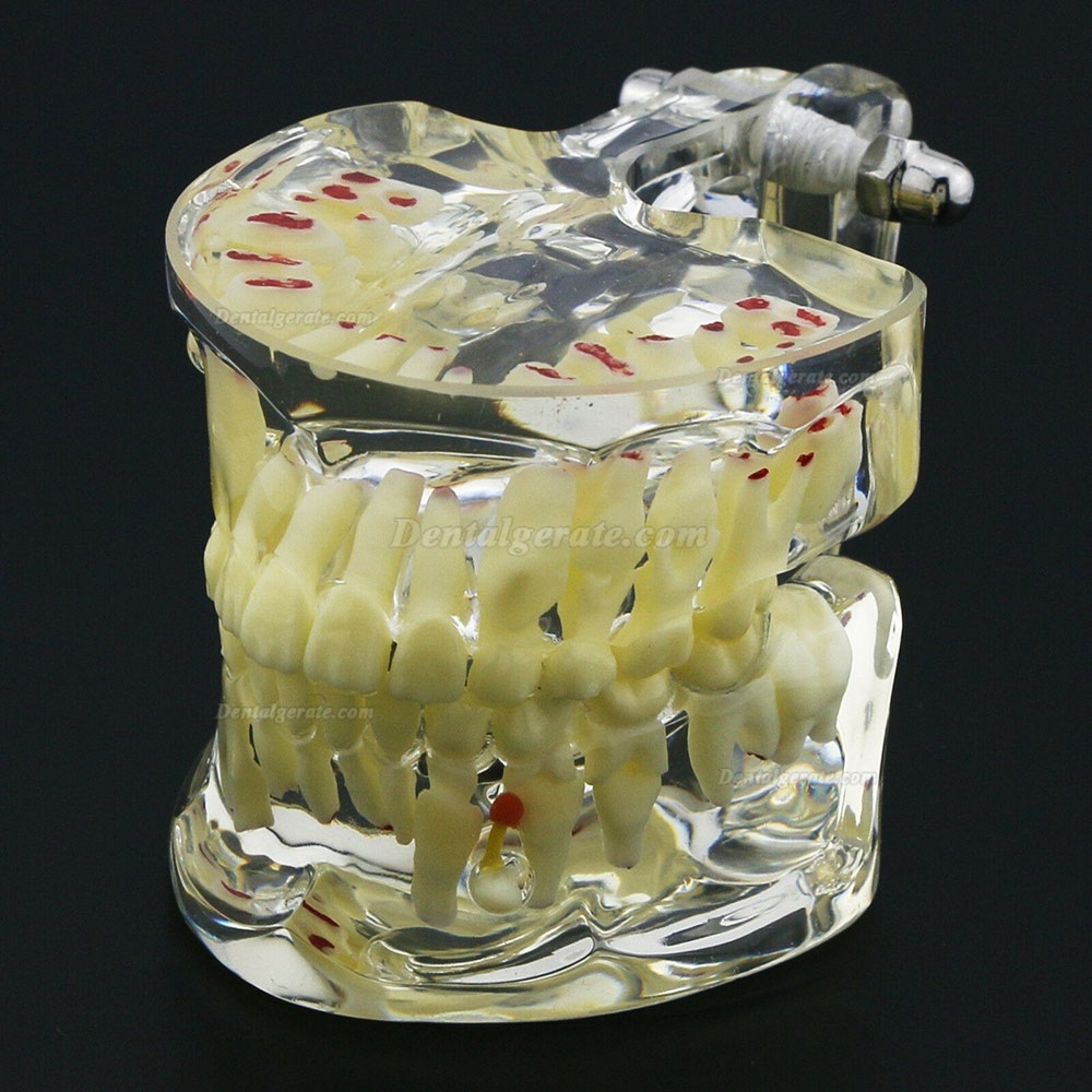 Zahnärztliche Kinderzahnmodell-Demonstrationsstudie Modell 4002 für Kinderpathologie Zahnärztliche Kinderzahnmodell-Demonstrationsstudie Modell 4002 für Kinderpathologie