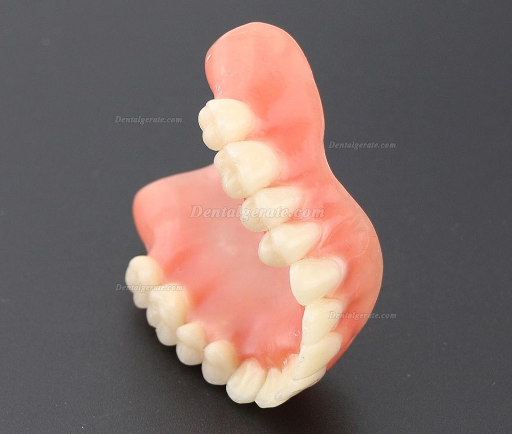 Dental Implantat rrepair Overdenture Oral Modell 6001