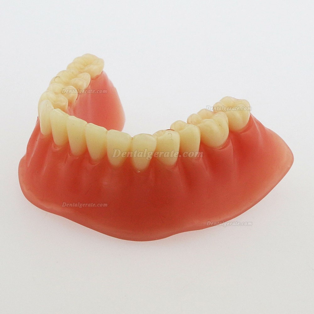 Dental Minderwertige Zähne Modell Overdenture Precision 4 Implantate Demo Silver Bar Dental Minderwertige Zähne Modell Overdenture Precision 4 Implantate Demo Silver Bar