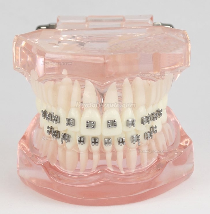 M3001 Dental Kieferorthopädie Behandlung Modell Demo Zähne MetallbracketsModel M3001 Dental Kieferorthopädie Behandlung Modell Demo Zähne MetallbracketsModel