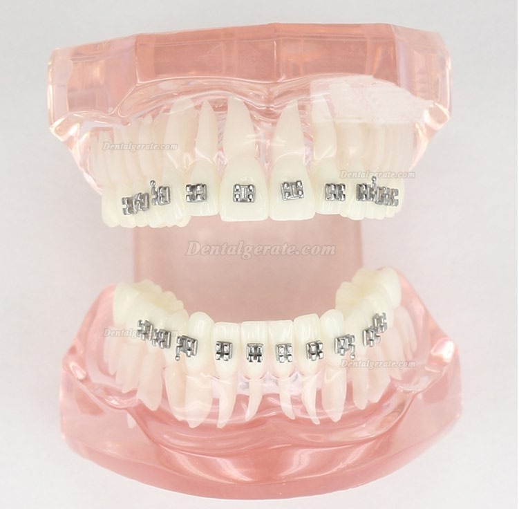 M3001 Dental Kieferorthopädie Behandlung Modell Demo Zähne MetallbracketsModel M3001 Dental Kieferorthopädie Behandlung Modell Demo Zähne MetallbracketsModel