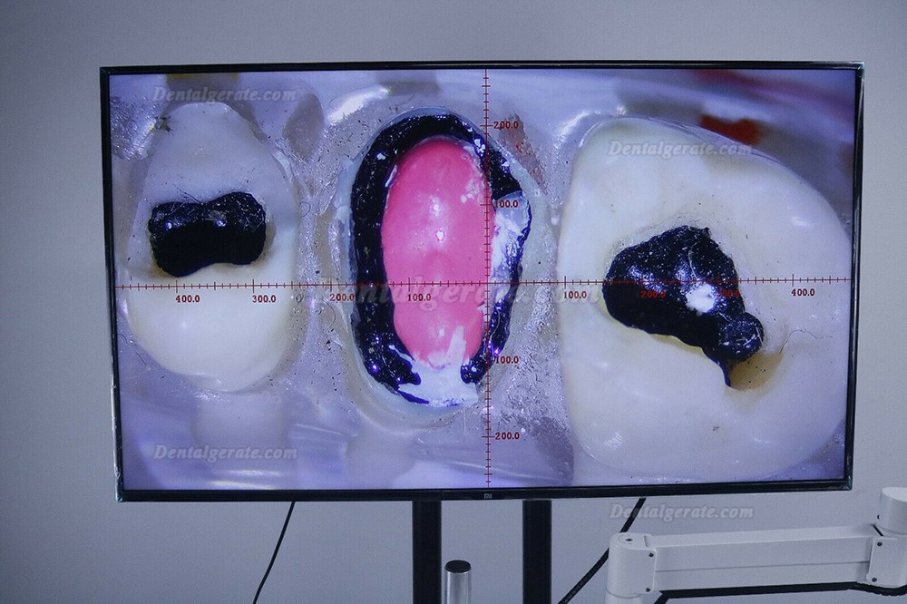Dentalmikroskope mit kamera f&uuml;r behandlungsstuhleinheit