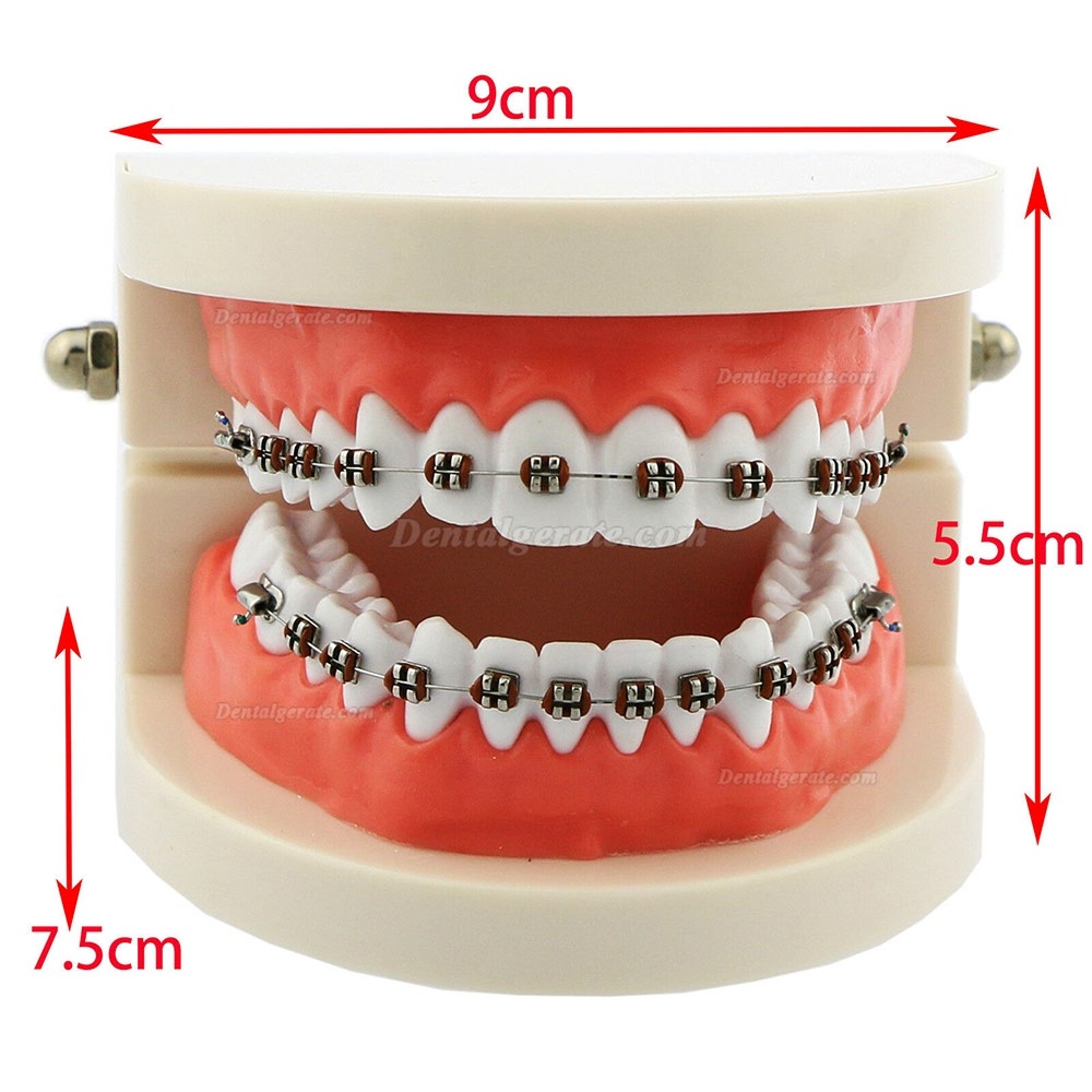 Modell für zahnärztliche kieferorthopädische Zähne + selbstligierende Kette aus Metallkeramik-Bracketrohr Modell für zahnärztliche kieferorthopädische Zähne + selbstligierende Kette aus Metallkeramik-Bracketrohr