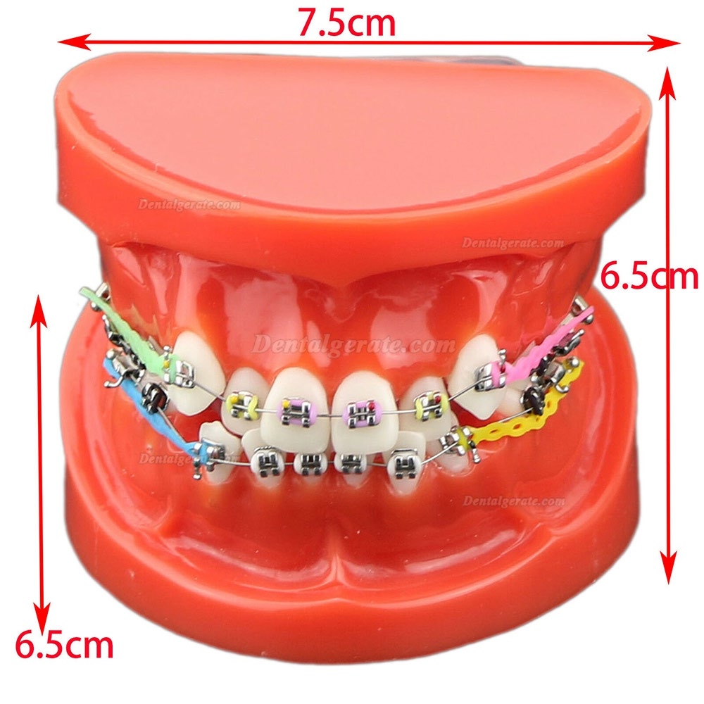 Modell für zahnärztliche kieferorthopädische Zähne + selbstligierende Kette aus Metallkeramik-Bracketrohr Modell für zahnärztliche kieferorthopädische Zähne + selbstligierende Kette aus Metallkeramik-Bracketrohr