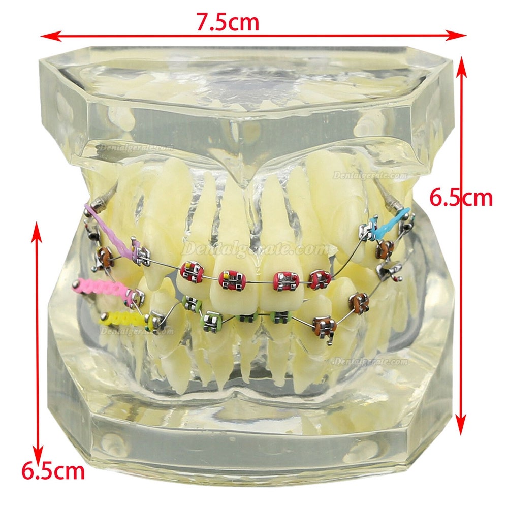 Modell für zahnärztliche kieferorthopädische Zähne + selbstligierende Kette aus Metallkeramik-Bracketrohr Modell für zahnärztliche kieferorthopädische Zähne + selbstligierende Kette aus Metallkeramik-Bracketrohr