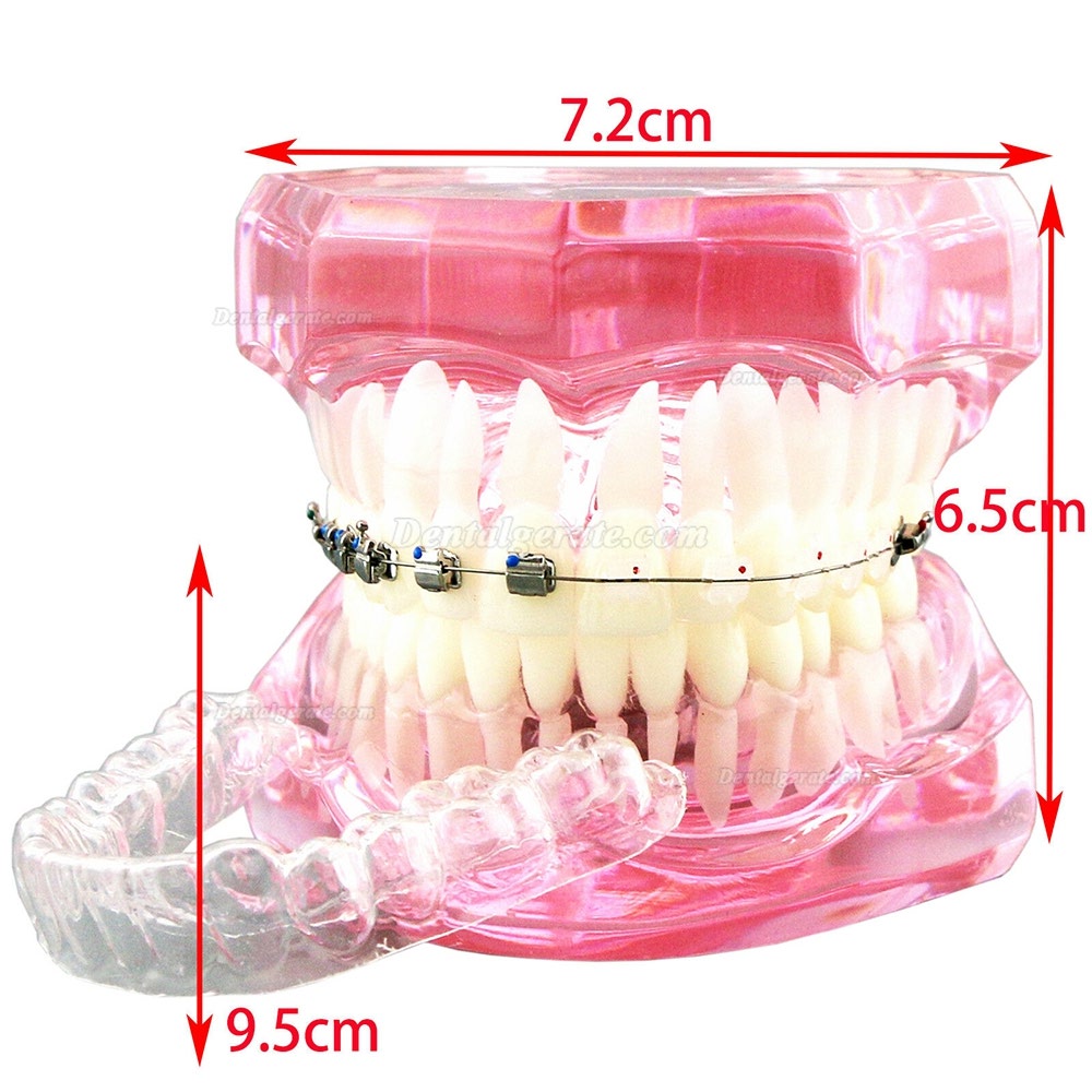 Modell für zahnärztliche kieferorthopädische Zähne + selbstligierende Kette aus Metallkeramik-Bracketrohr Modell für zahnärztliche kieferorthopädische Zähne + selbstligierende Kette aus Metallkeramik-Bracketrohr