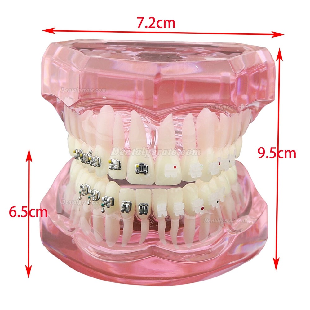 Modell für zahnärztliche kieferorthopädische Zähne + selbstligierende Kette aus Metallkeramik-Bracketrohr Modell für zahnärztliche kieferorthopädische Zähne + selbstligierende Kette aus Metallkeramik-Bracketrohr