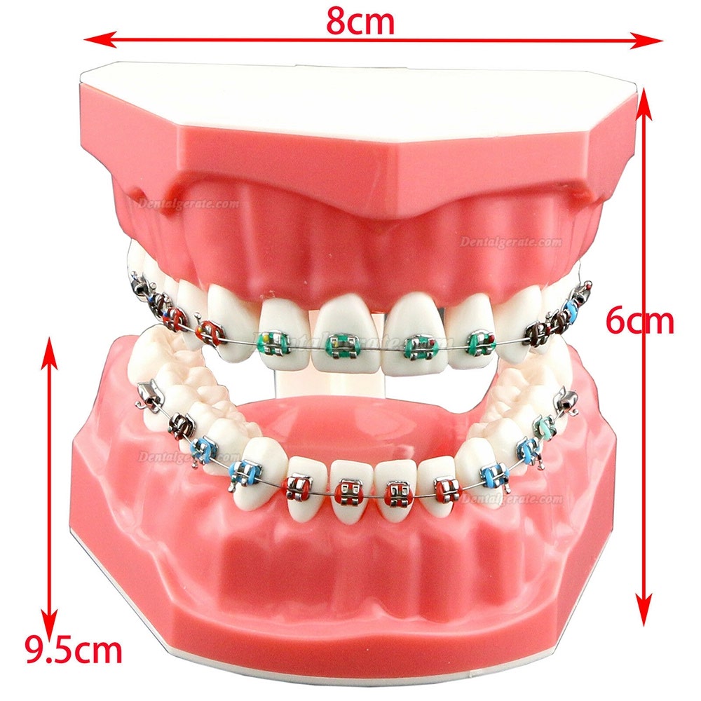 Modell für zahnärztliche kieferorthopädische Zähne + selbstligierende Kette aus Metallkeramik-Bracketrohr Modell für zahnärztliche kieferorthopädische Zähne + selbstligierende Kette aus Metallkeramik-Bracketrohr