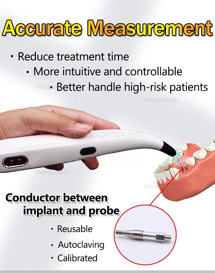 Implantat Stabilit&auml;t Messung, Osseointegrations Messger&auml;t, ISQ Messger&auml;t