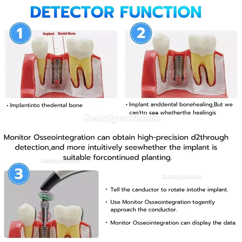 Implantat Stabilit&auml;t Messung, Osseointegrations Messger&auml;t, ISQ Messger&auml;t