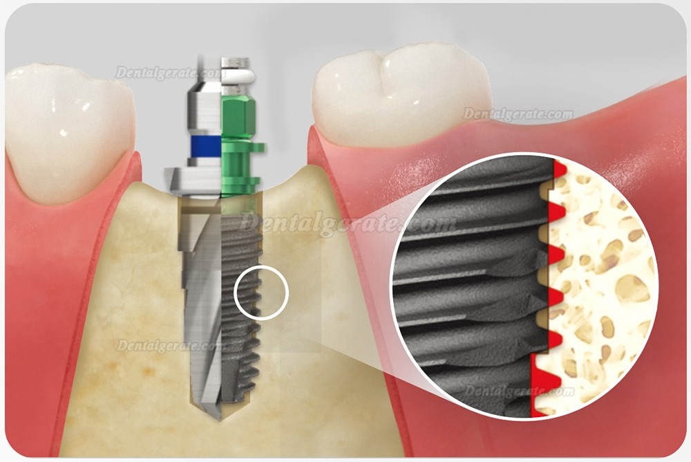 Osstem Hiossen Taper-Chirurgieset mit Drehmomentschl&uuml;ssel (Verwendung f&uuml;r TSⅢ/Ⅳ SSⅢ USⅢ/Ⅳ)