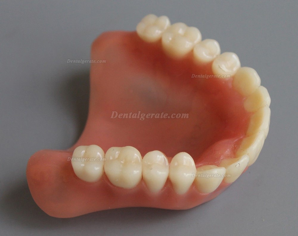Dental Abnehmbare Overdenture Inferior mit 4 Implantaten Demo Z&auml;hne Studie Modell