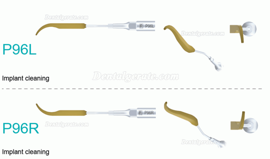 5 St&uuml;ck Refine&reg; Ultraschall Piezo Spitzen f&uuml;r Implantatreinigung P90 P94 P95 P96L P96R (Kompatible mit REFINE EMS MECTRON Woodpeaker)