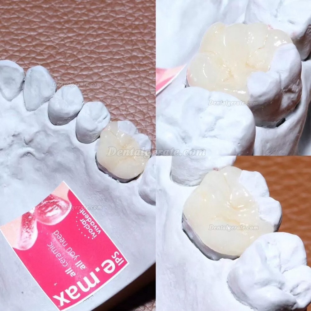 PHOENX OP6010A Plus Keramikpressofen Mit Vakuumpumpe zum Brennen von Keramikmaterial f&uuml;r Z&auml;hne