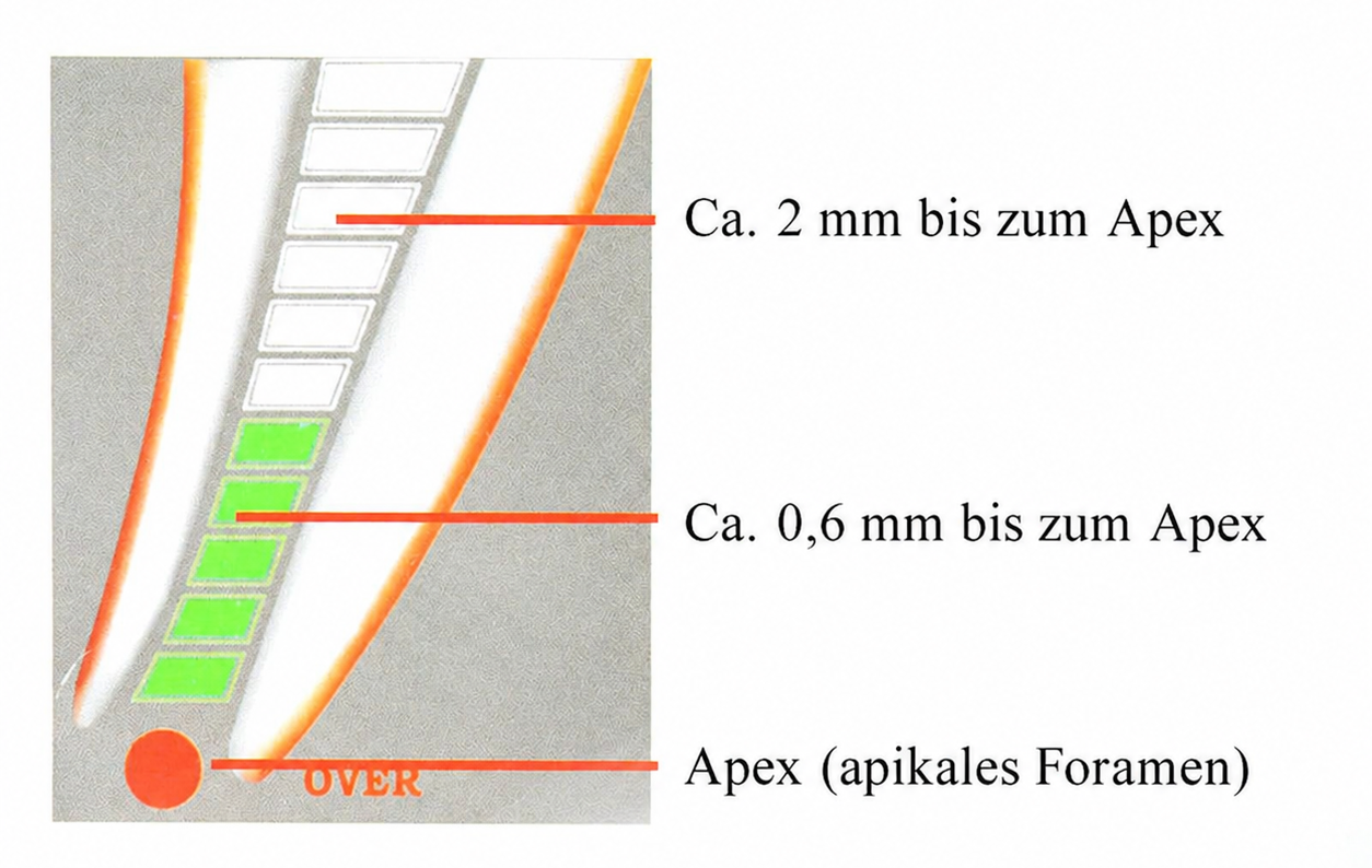 4.5 LCD Dental Wurzelkanal Apexlokalisator Endodontic Finder RPEX 6