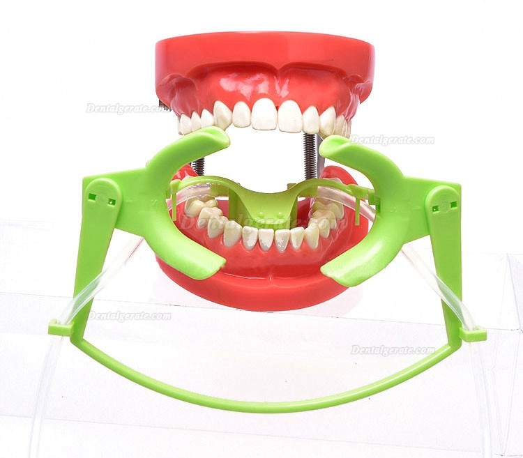 1 Stk. Dental Mund&ouml;ffner mit Speichelsaugrohr (Zahnbleaching wangenretraktor)