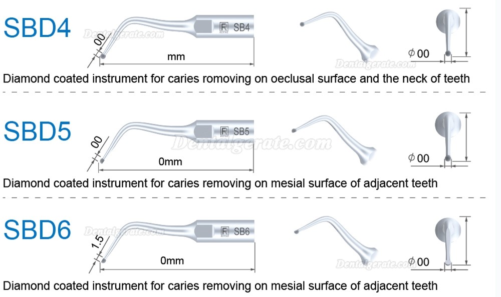 5 St&uuml;cke Refine&reg; Ultraschall Scaler Spitzen f&uuml;r Restauration SBD1 SBD2 SBD3 SBD4 SBD5/6 SBDR SBDL SBD7L SBD7R Kompatibel SATELEC NSK DTE GNATUS