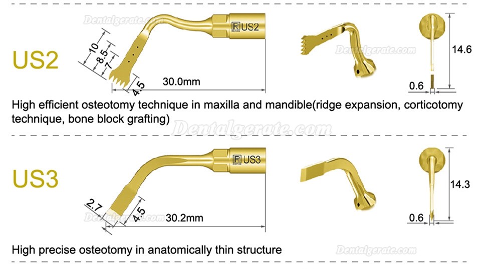 1 St&uuml;cke Refine&reg; Piezosurgery Osteotomie Knochenschneiden Spitze US1 US1L US1R US2 US3 US4 US5 US6 US7 US11 US12 (Kompatibel Mit Mectron Woodpecker)