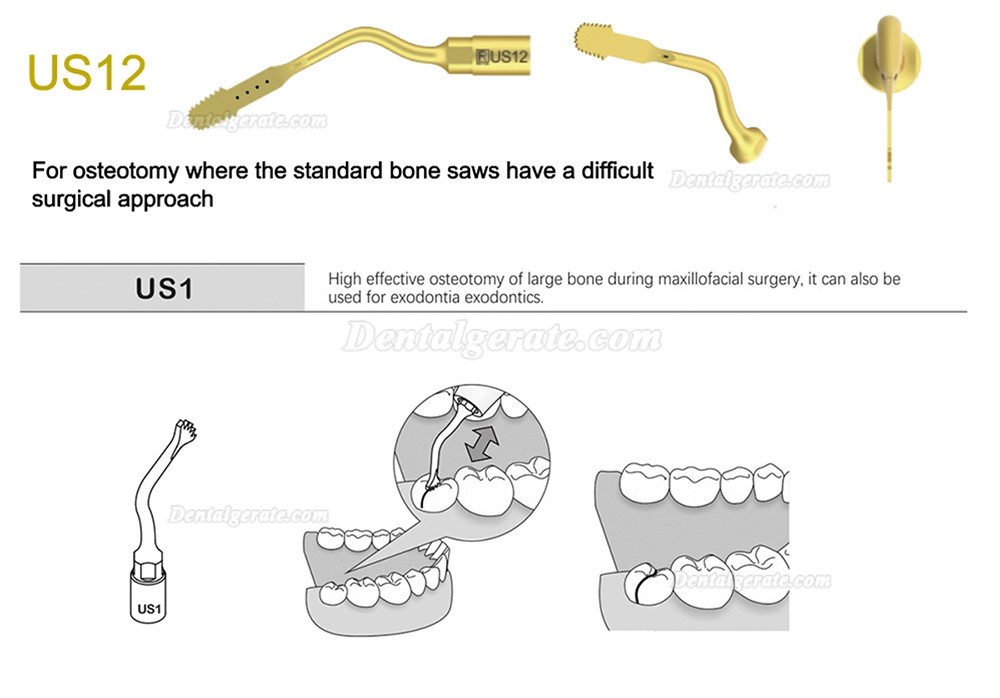 1 St&uuml;cke Refine&reg; Piezosurgery Osteotomie Knochenschneiden Spitze US1 US1L US1R US2 US3 US4 US5 US6 US7 US11 US12 (Kompatibel Mit Mectron Woodpecker)