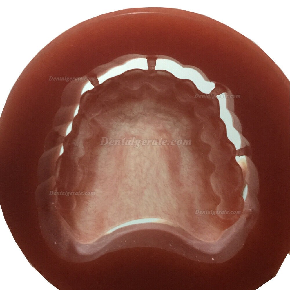 5 St&uuml;ck 98 Dentallabor Rosa PMMA Ronden mit Bloodshot (f&uuml;r Wieland CAD/CAM Fr&auml;smaschine)