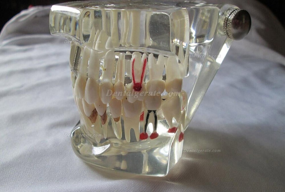 Z&auml;hne Modell f&uuml;r dentisty Bildung/Studie Erwachsene Standard 5.2 Demonstration