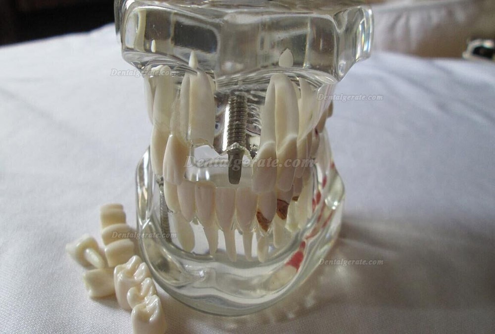 Z&auml;hne Modell f&uuml;r dentisty Bildung/Studie Erwachsene Standard 5.2 Demonstration