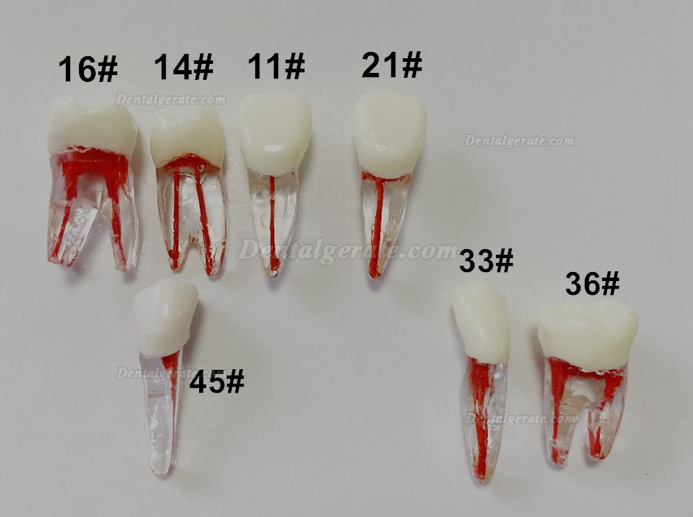 Dental Modellz&auml;hne Endo &Uuml;bungszahn Molarer Oberer Unterer Zahn Pr&auml;molarenwurzel 2/3-wurzeliger Kanal