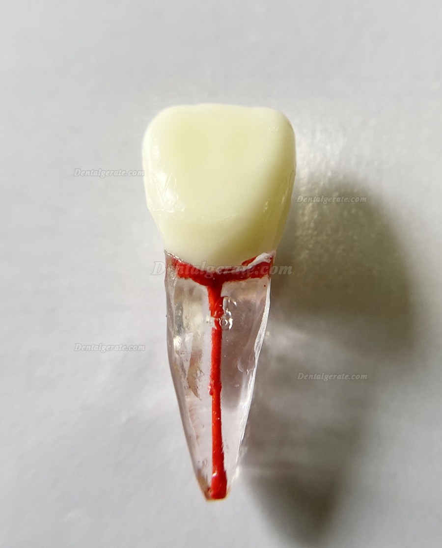 Dental Modellz&auml;hne Endo &Uuml;bungszahn Molarer Oberer Unterer Zahn Pr&auml;molarenwurzel 2/3-wurzeliger Kanal