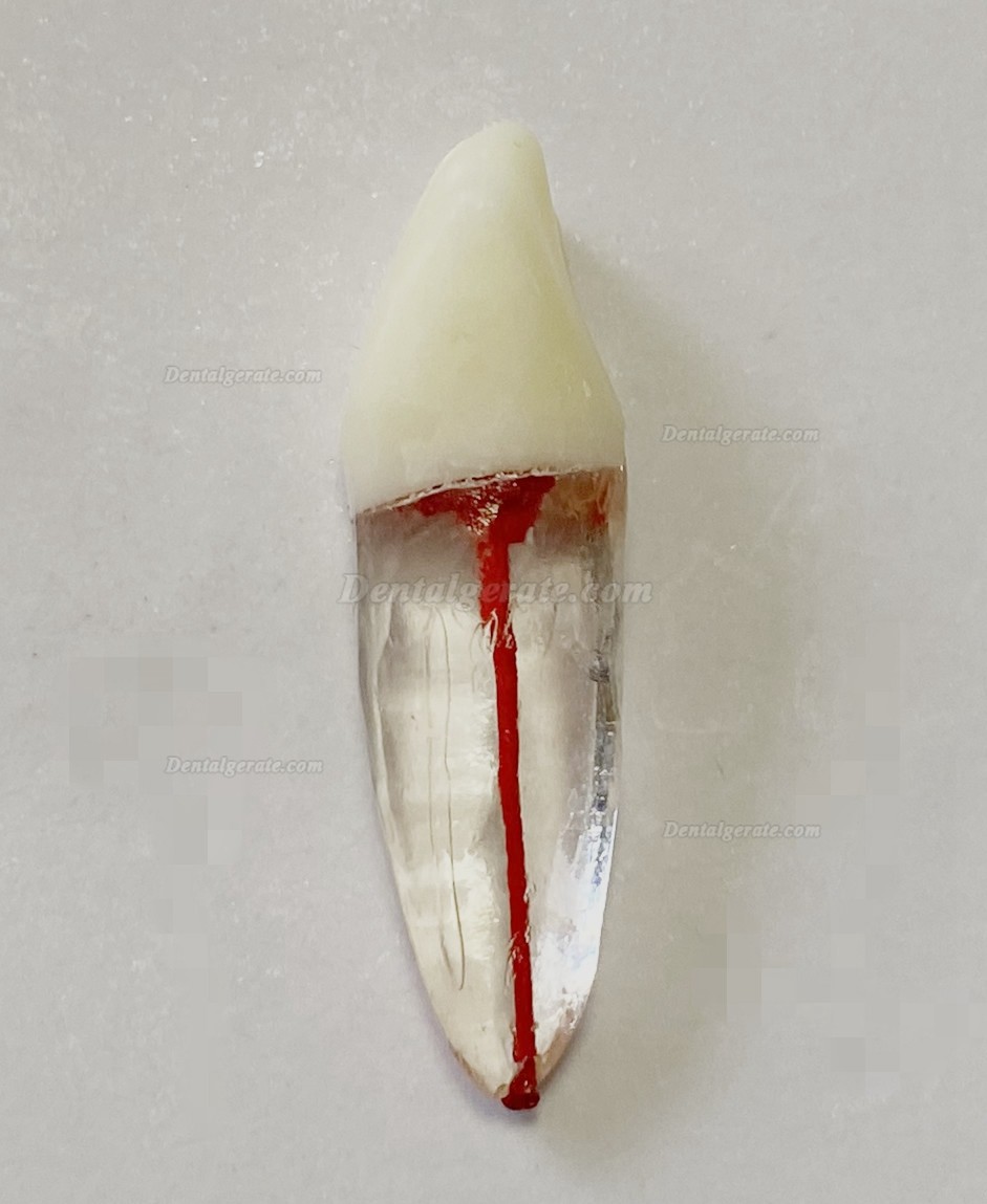 Dental Modellz&auml;hne Endo &Uuml;bungszahn Molarer Oberer Unterer Zahn Pr&auml;molarenwurzel 2/3-wurzeliger Kanal