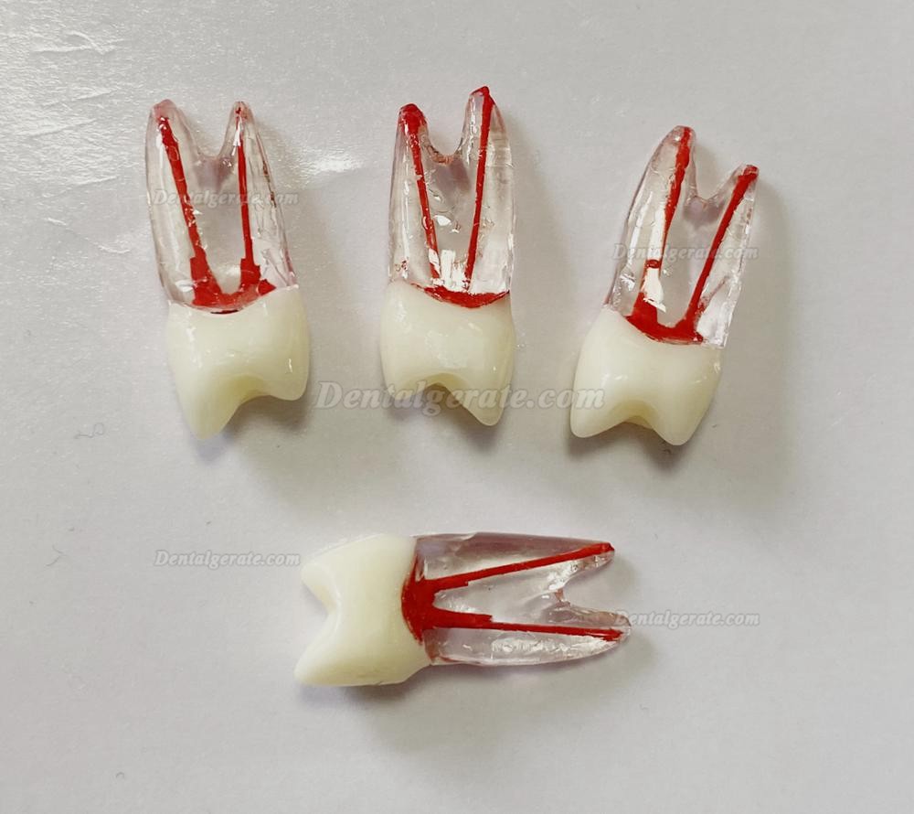 Dental Modellz&auml;hne Endo &Uuml;bungszahn Molarer Oberer Unterer Zahn Pr&auml;molarenwurzel 2/3-wurzeliger Kanal