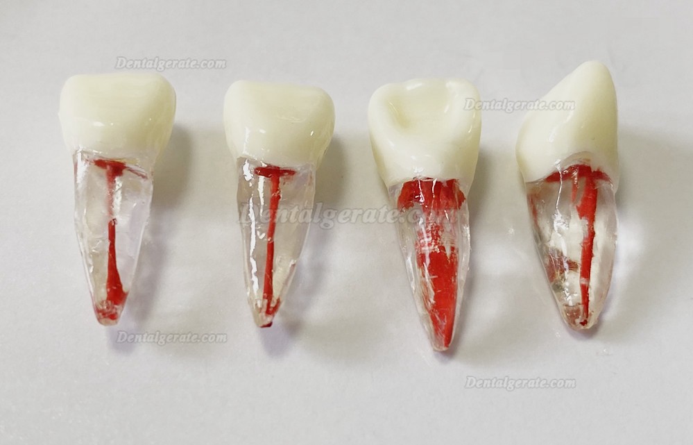 Dental Modellz&auml;hne Endo &Uuml;bungszahn Molarer Oberer Unterer Zahn Pr&auml;molarenwurzel 2/3-wurzeliger Kanal