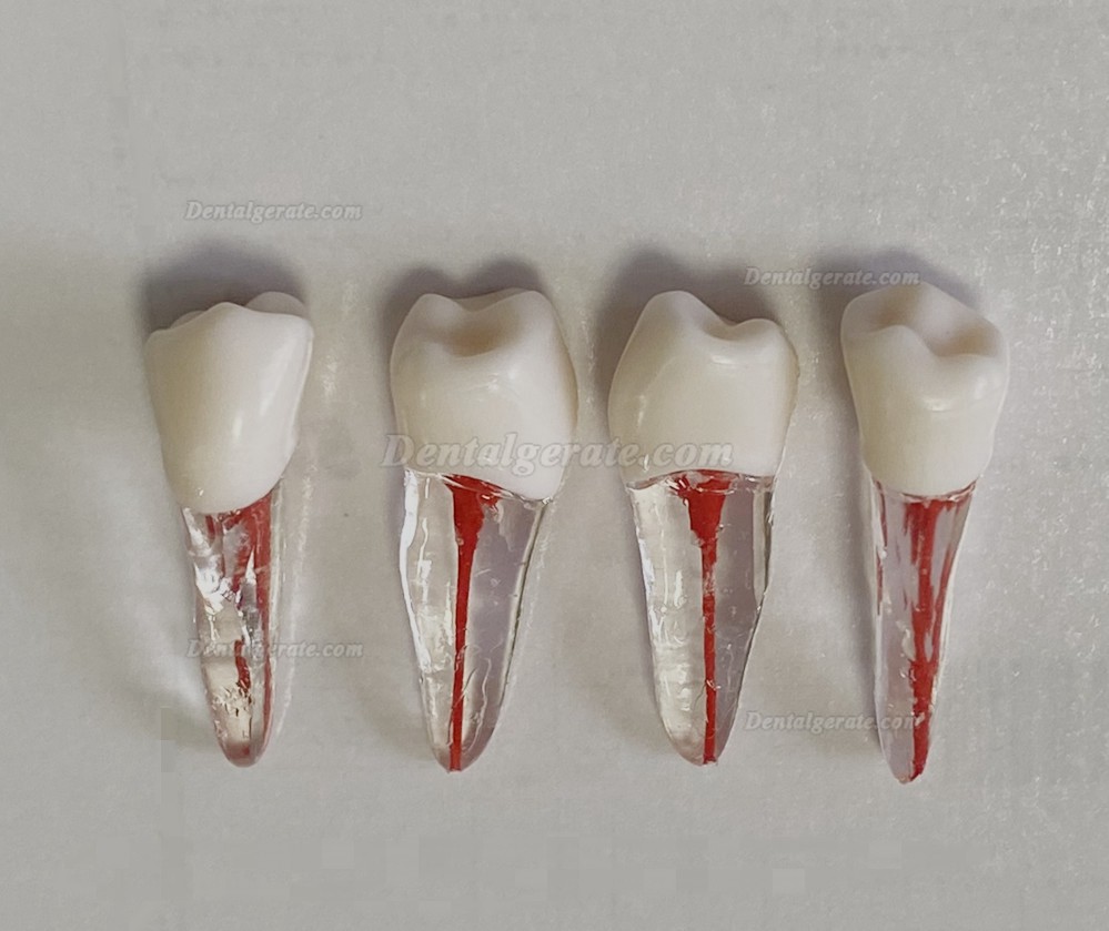 Dental Modellz&auml;hne Endo &Uuml;bungszahn Molarer Oberer Unterer Zahn Pr&auml;molarenwurzel 2/3-wurzeliger Kanal