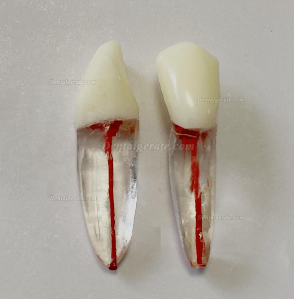 Dental Modellz&auml;hne Endo &Uuml;bungszahn Molarer Oberer Unterer Zahn Pr&auml;molarenwurzel 2/3-wurzeliger Kanal