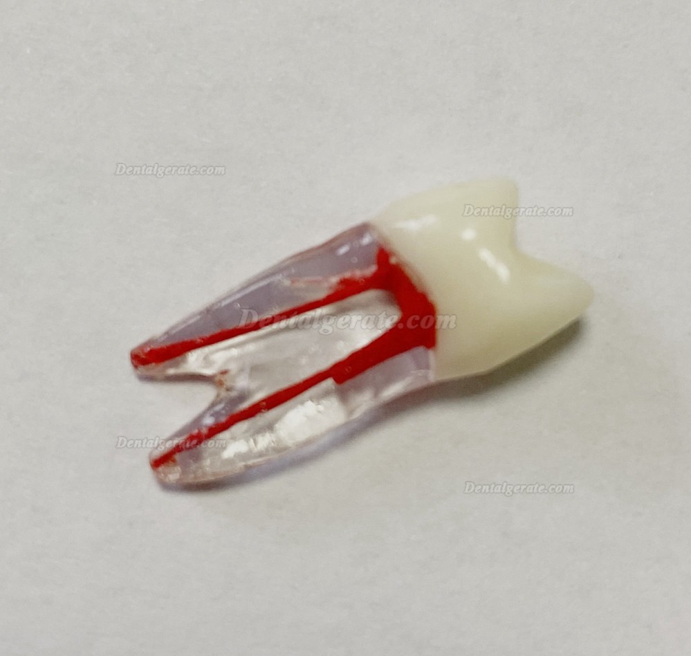Dental Modellz&auml;hne Endo &Uuml;bungszahn Molarer Oberer Unterer Zahn Pr&auml;molarenwurzel 2/3-wurzeliger Kanal