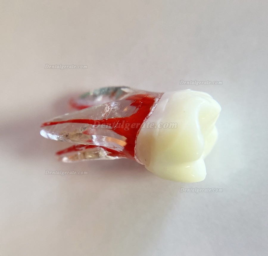 Dental Modellz&auml;hne Endo &Uuml;bungszahn Molarer Oberer Unterer Zahn Pr&auml;molarenwurzel 2/3-wurzeliger Kanal