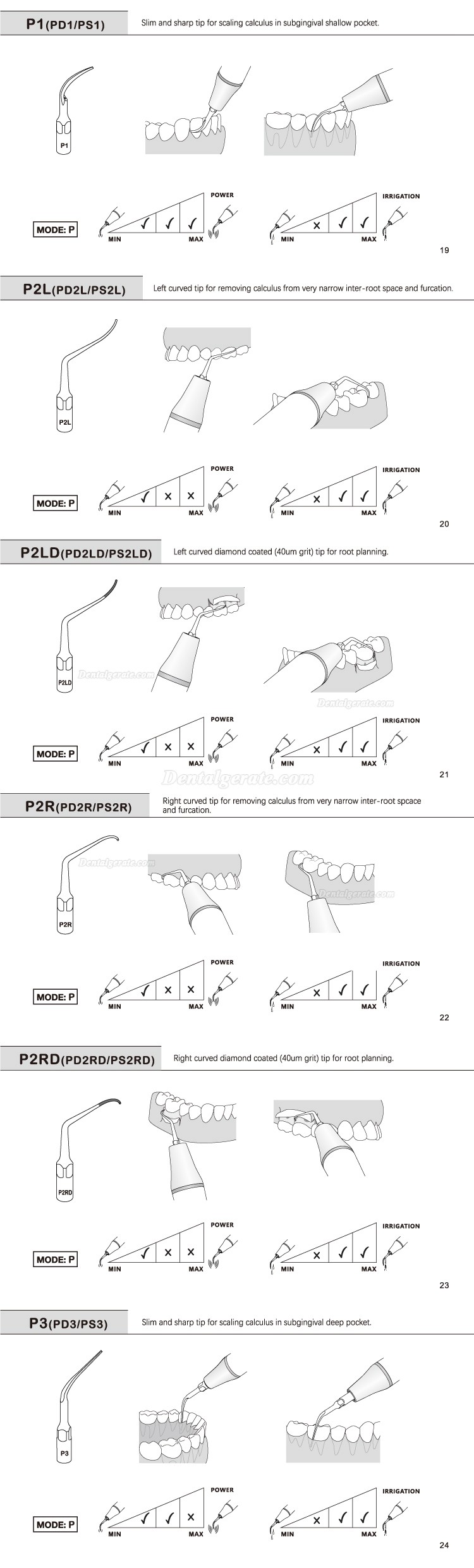 5 St&uuml;cke Refine&reg; Ultraschall Scaler Spitzen f&uuml;r Parodontologie P2L P2R P2LD P2RD P5 P6 P7 P8 P10 P11 P12 P14L Kompatibel EMS Woodpecker