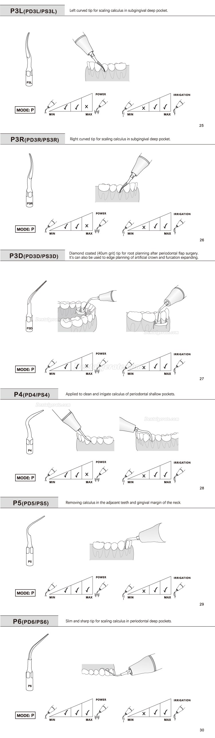 5 St&uuml;cke Refine&reg; Ultraschall Scaler Spitzen f&uuml;r Parodontologie P2L P2R P2LD P2RD P5 P6 P7 P8 P10 P11 P12 P14L Kompatibel EMS Woodpecker