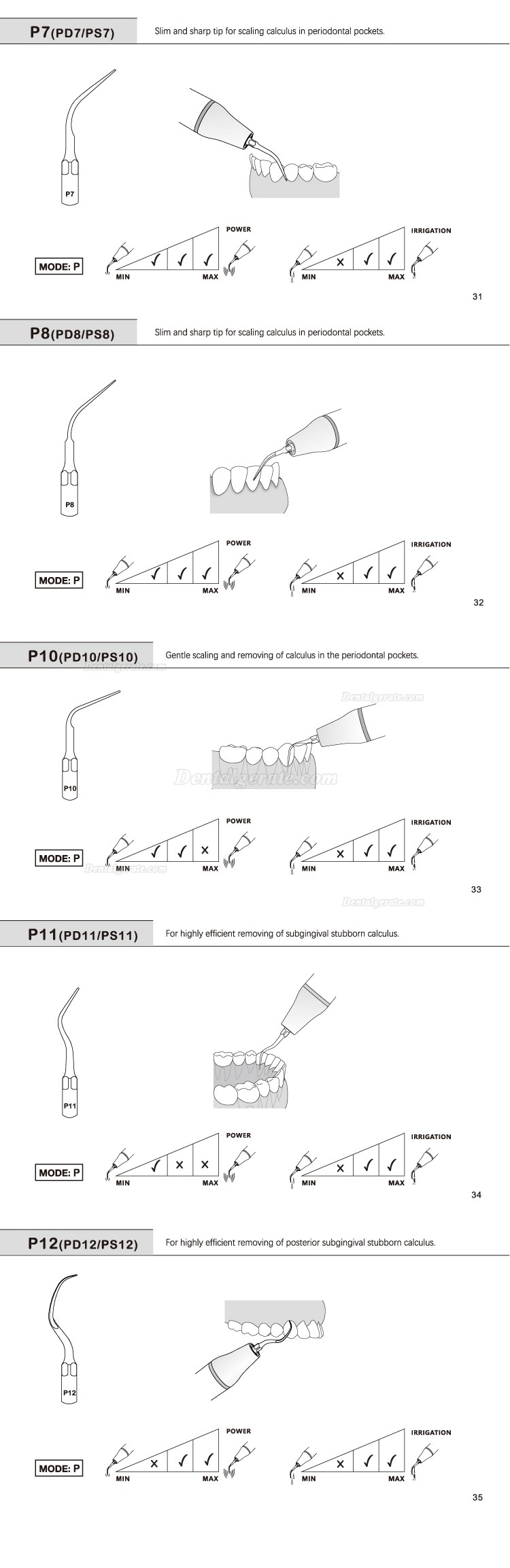 5 St&uuml;cke Refine&reg; Ultraschall Scaler Spitzen f&uuml;r Parodontologie P2L P2R P2LD P2RD P5 P6 P7 P8 P10 P11 P12 P14L Kompatibel EMS Woodpecker