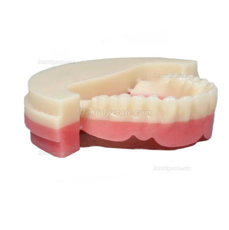 5 Stück PMMA Ronden OD98*25mm Zweifarbig A2+Rosa PMMA Fräsrohlinge (für Wieland CAD/CAM Fräsmaschine) 5 Stück PMMA Ronden OD98*25mm Zweifarbig A2+Rosa PMMA Fräsrohlinge (für Wieland CAD/CAM Fräsmaschine)