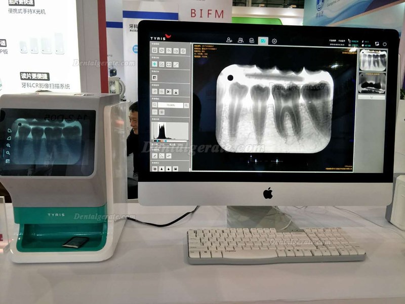 TYRIS TR-200 Dental Image Plate Scanner PSP X ray Scanner with True-color Touch ScreenTYRIS TR-200 Speicherfolienscanner