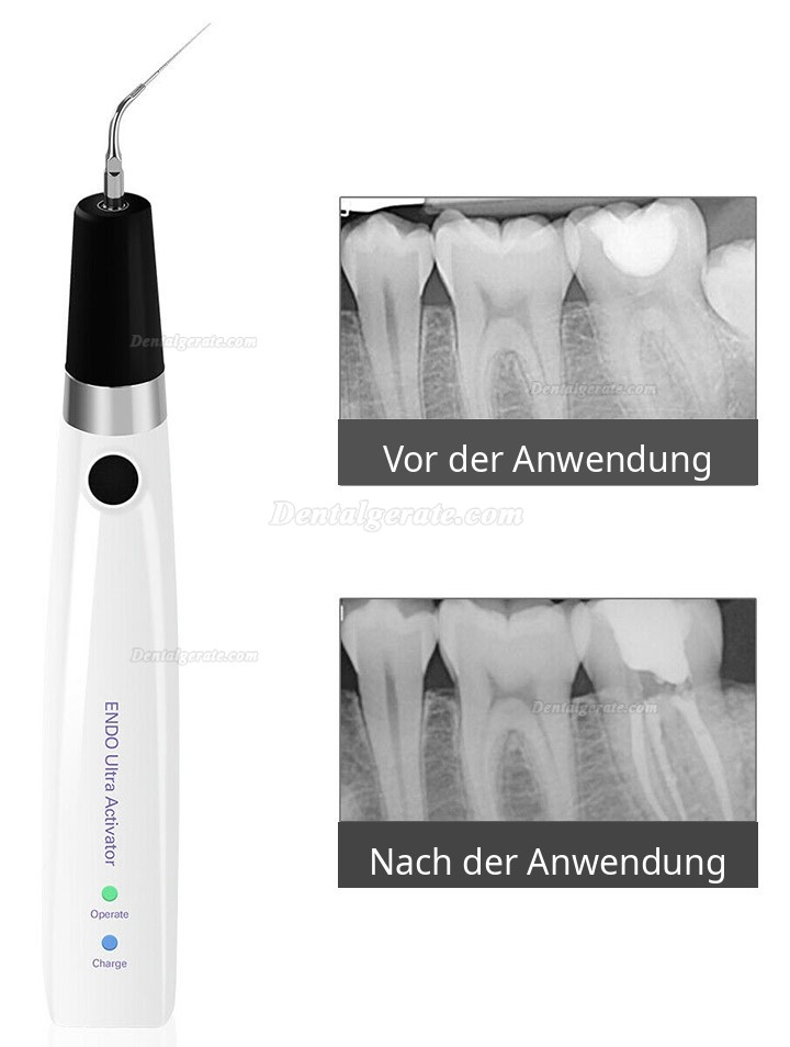 Ultraschall Wurzelkanalsp&uuml;ler Handst&uuml;ck Endo Ultra