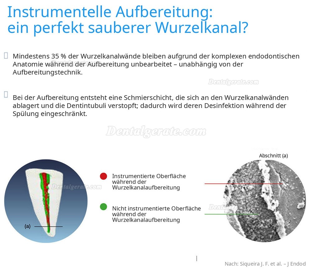 Ultraschall Wurzelkanalsp&uuml;ler Handst&uuml;ck Endo Ultra