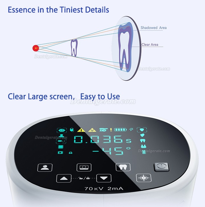 Woodpecker Mini Ray Mobiles R&ouml;ntgenger&auml;t Zahnarzt | Handger&auml;t Digitale R&ouml;ntgensysteme
