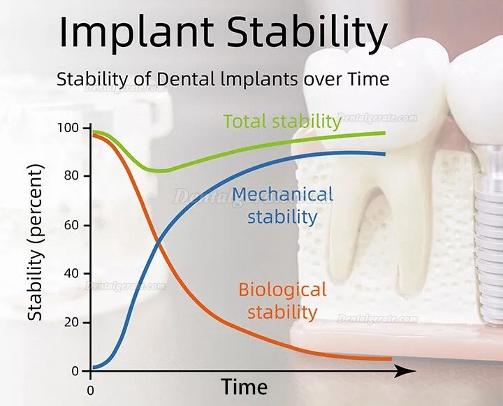 YAHOPE iCHECK Implantat Stabilit&auml;t Messung, ISQ Monitor (Implant Stability Quotient Messger&auml;t)