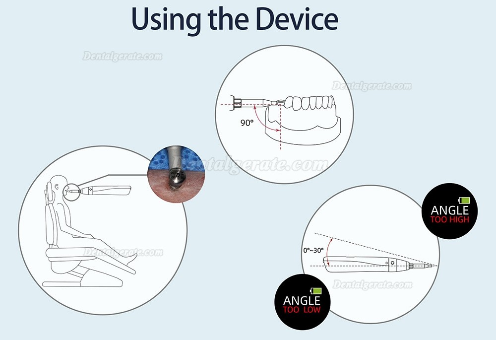 YAHOPE iCHECK Implantat Stabilit&auml;t Messung, ISQ Monitor (Implant Stability Quotient Messger&auml;t)