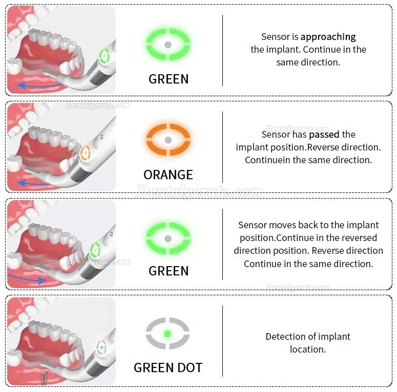 YAHOPE iD1 Dental Implantatfinder, Implant Spotter, Implantatdetektor