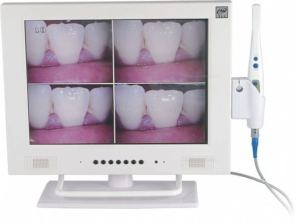 MLG&reg; M-958A 15-Zoll-LCD und 1/4 SONY CCD hohe Aufl&ouml;sende Intraoral kamera